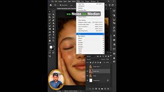 How to Remove Freckles Tips Adobe Photoshop 2025