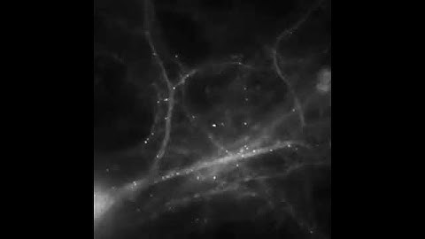 The Molecular Basis of Memory Tracking mRNA in Brain Cells in Real Time Low
