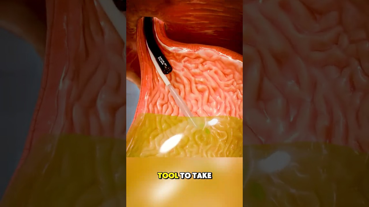 Nasal Turbinate Surgery – Symptoms You May Ignore  