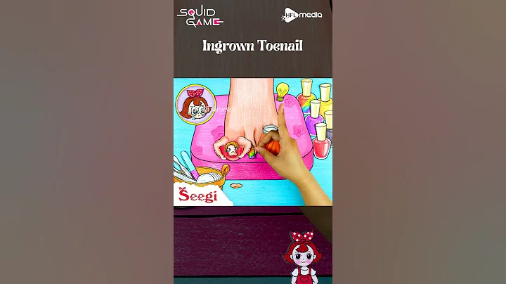 Squid Game - ASMR Funny Ingrown Toenail Removal #shorts