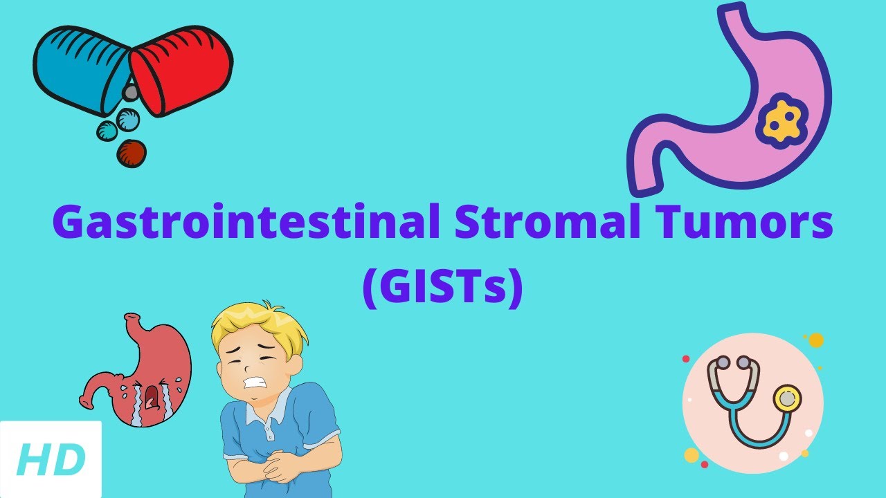 GIST: Gastrointestinaler Stromatumor – eine interdisziplinäre Fallbesprechung