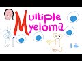 Multiple Myeloma | A Malignancy of Plasma Cells!