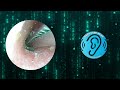 ASMR Ear Cleaning | Guaranteed Tingles and Instant Relaxation