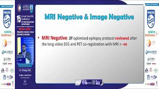 Imaging in Pediatric Epilepsysearching for the Caus