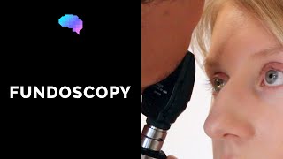 Fundoscopy (Ophthalmoscopy) - Osce Guide | Ukmla | Cpsa