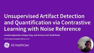 Famous Unsupervised Artifact Detection and Quantification via Contrastive Learning with Noise Reference Net Worth