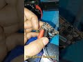 headphone removed solutions