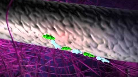 Metastasis 3D Animation