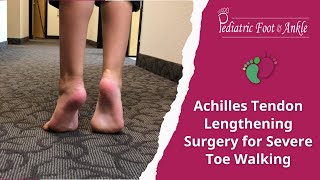 Achilles Tendon Lengthening Surgery for Severe Toe Walking