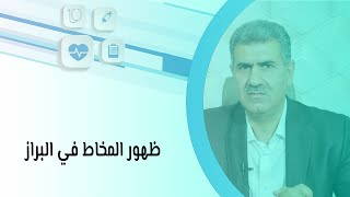 أسباب ظهور المخاط في البراز وعلى ماذا يدل؟ وما هو العلاج