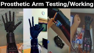 Prosthetic Arm testing | working of Prosthetic Arm using EMG Muscle Sensor