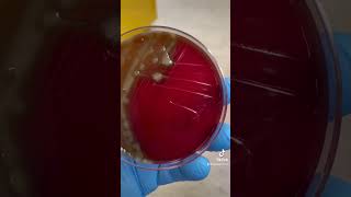 Streptococcus pneumoniae Profile