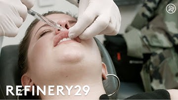 Our Botox & Juvederm Lip Injections Experience | Try This Challenge | Refinery29