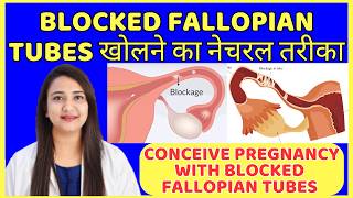 BLOCKED FALLOPIAN TUBES खोलने का नेचरल तरीका | CONCEIVE PREGNANCY WITH BLOCKED FALLOPIAN TUBES
