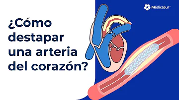 ¿Cómo destapan los médicos una arteria?