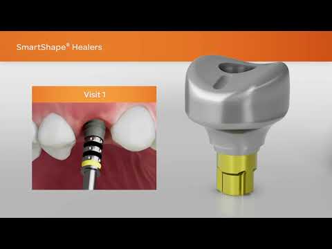 Ein effizienterer Workflow für Implantatversorgungen | SmartShape Healer von BioHorizons