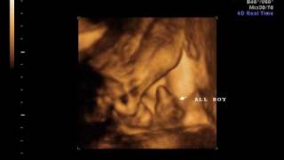 My Son Born An Angel