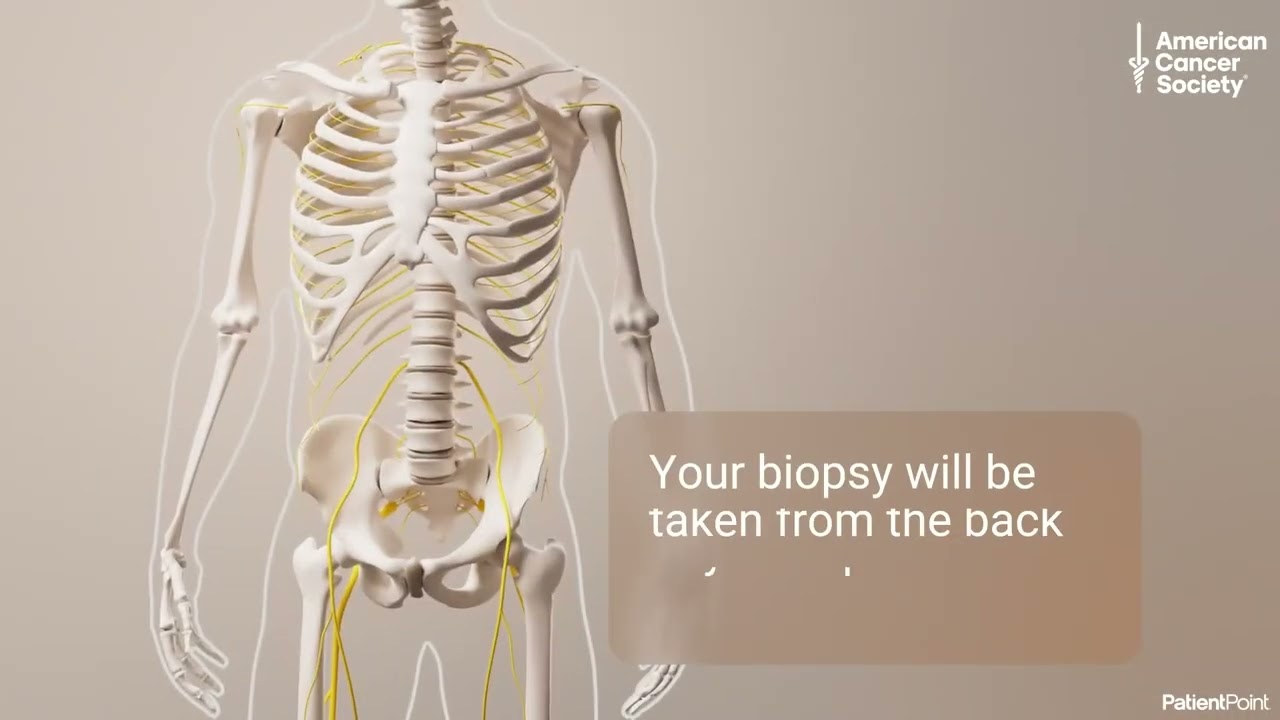 Bone Marrow Biopsy Procedure: What to Expect