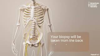Bone Marrow Biopsy Procedure: What to Expect