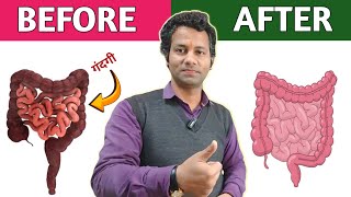 आंतो की सफाई करें, सालों पुराना सूखा मल होगा बाहर | आंतों का मूवमेंट कैसे बढ़ाएं  |Dr tarun