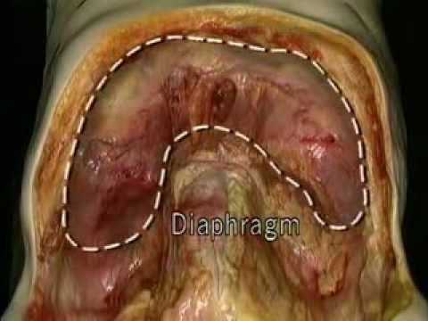 Видео Строение Человека