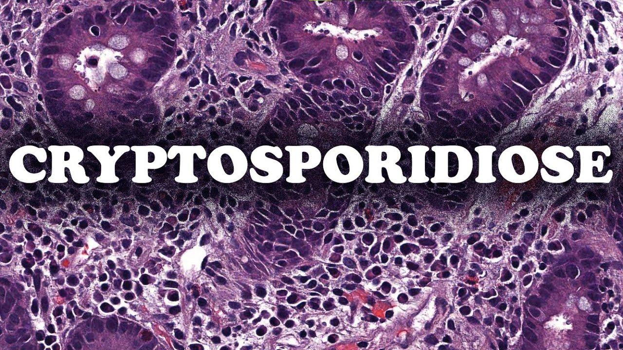 LA CRYPTOSPORIDIOSE – PATHOLOGIE