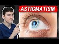 Astigmatism Explained - What You Need to Know!