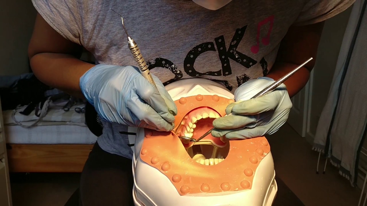 Cusp buildup Class 6 My Practice session at home for ORE EXAM 😄 YouTube