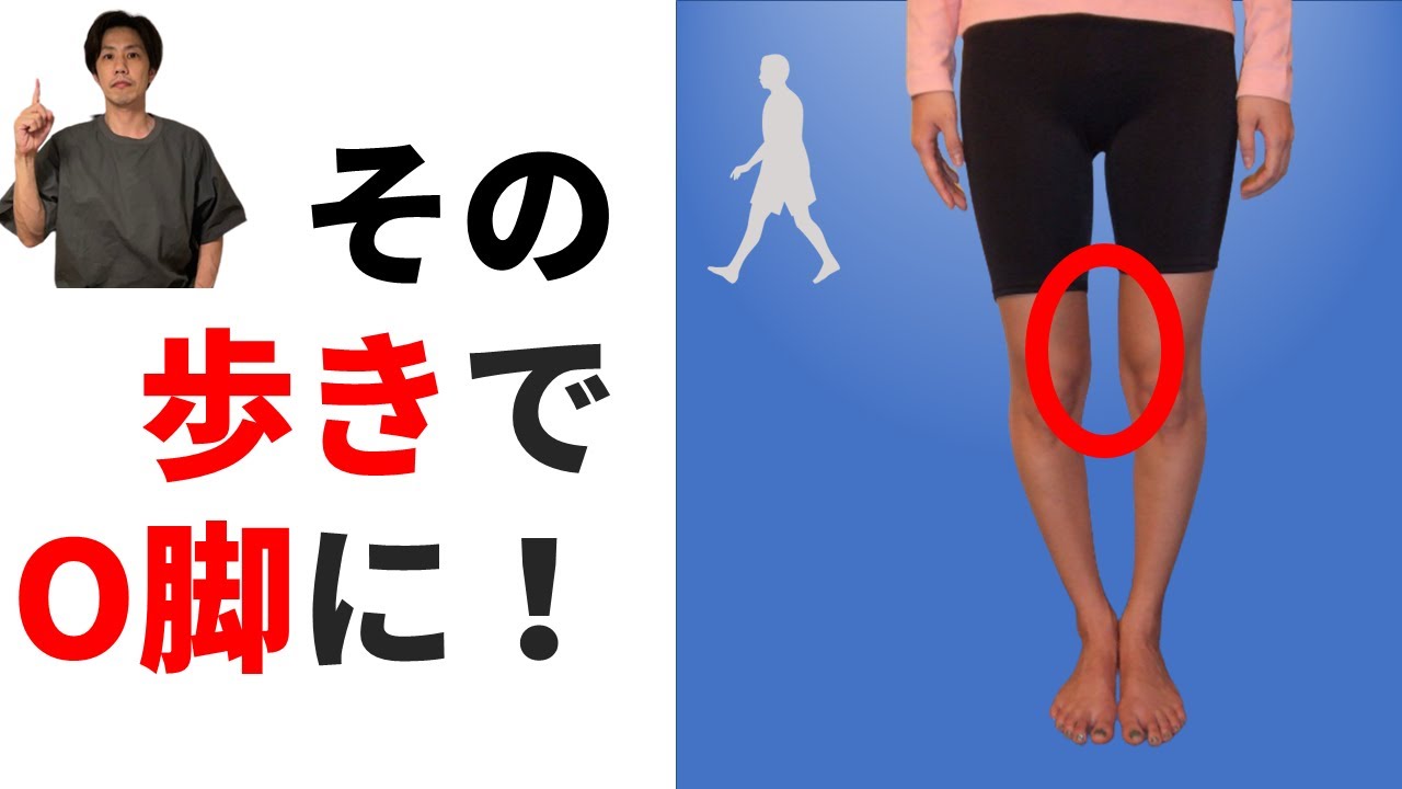【要注意】その歩き方だとО脚に！歩き方でО脚を治す方法！