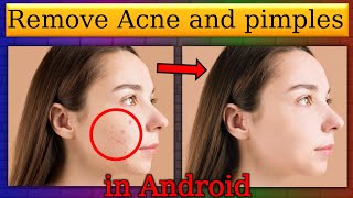 Clean up picture in mobile fone || remove acni and pimples on picture || photo editor