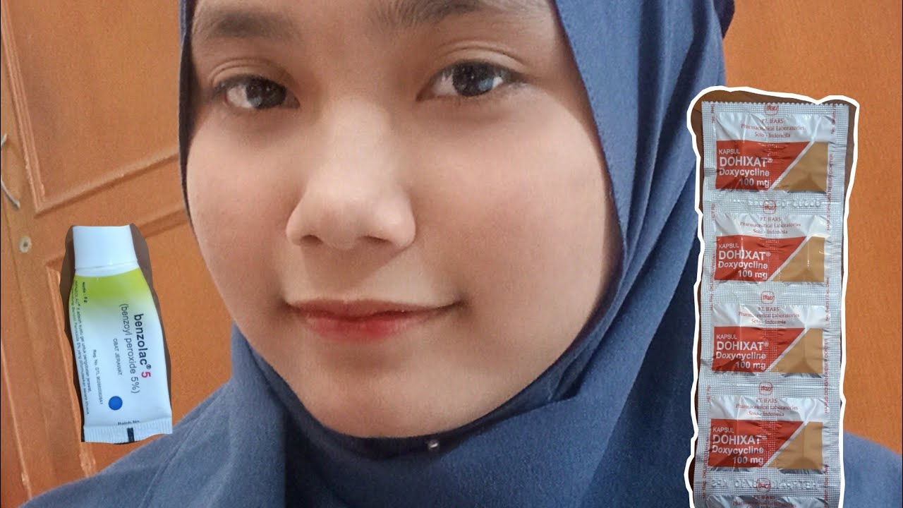 Cara menghentikan pertumbuhan jerawat yang meradang 