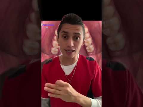 Video: 3 formas de limpiar los dientes manchados de nicotina