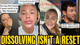 Women Are Dissolving Their Filler And Their Face Still Isn t The Same