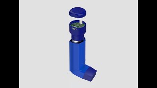 SAANS The Smart Solution for Respiratory Management