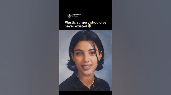 Plastic surgery should've never existed. Kim Kardashian was naturally beautiful 😭🩷