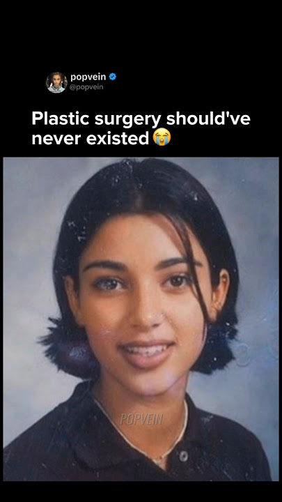 Plastic surgery should've never existed. Kim Kardashian was naturally beautiful 😭🩷
