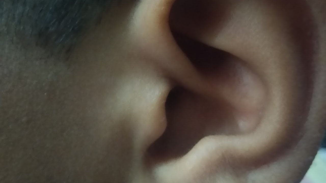 External auditory canal | External auditory meatus | Why earpiece of stethoscope is pointed forwards