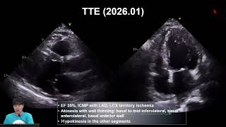 K CTO CLUB the 10th mini webinar Part #1