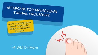 What You Need To Know After An Ingrown Toenail Removal