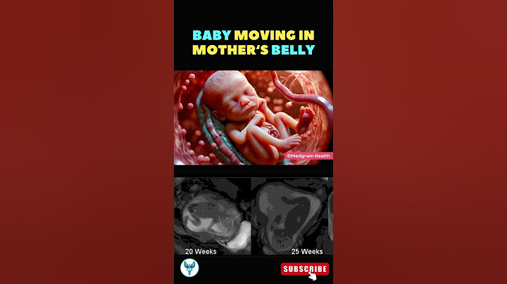 Baby movement 💕  Fetal movement | Baby moving inside mother's womb #shortsfeed #baby #pregnancy