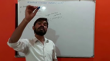 Sphere of death,  motion of vehicle on convex and concave bridge