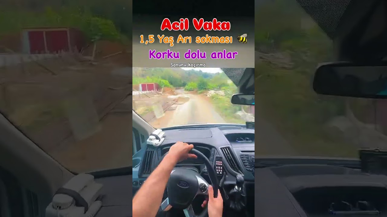 Arı sokması Ölümle Sonunçlanan vakalardandır..