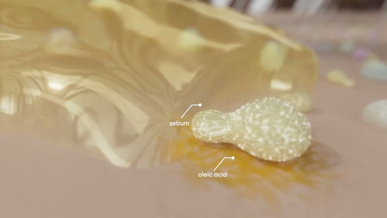 Role of Malassazia in Dandruff