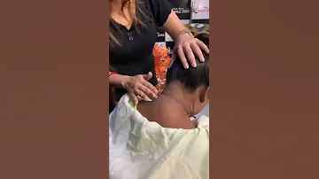 Neck Patches Removing Easy Tips Skincare Soap Crystalglow Fashionhacks Falaknaaz 