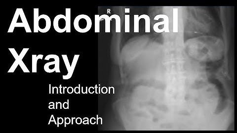 Abdominal X-Ray: Introduction and Approach