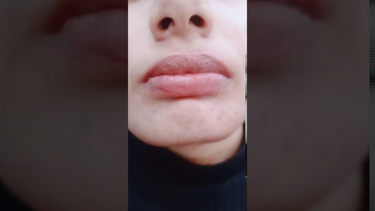 cut fat lips and light eyebrow & eyelashes hair dandruff hair damage ke liye home remedy