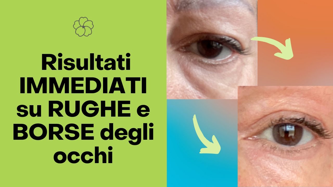 Borse sotto gli occhi e rughe del contorno occhi: ecco 3 gesti infallibili
