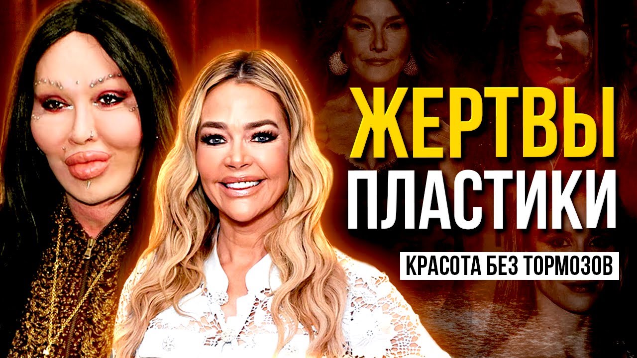 ЖЕРТВЫ ПЛАСТИКИ: Они ПРОИГРАЛИ гонку за красотой