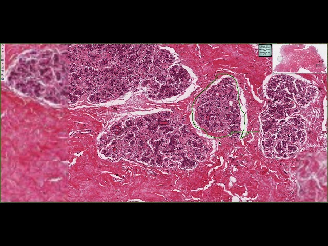 Inactive Mammary Gland Histology