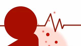 Cringe. Sticknodes With Umvc3 Sound Effect